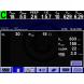 LEAK COMPENSATION SOFTWARE OPTION (Puritan Bennett)