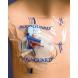 AQUAGUARD MOISTURE BARRIER DRESSINGS