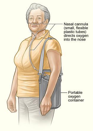 oxygen_therapy.jpg