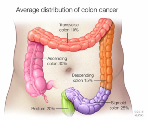 Download Symptoms Facts Strides For Life Colon Cancer Foundation For iPhone Free Get Wallpaper Symptoms Facts Strides For Life Colon Cancer Foundation For Android